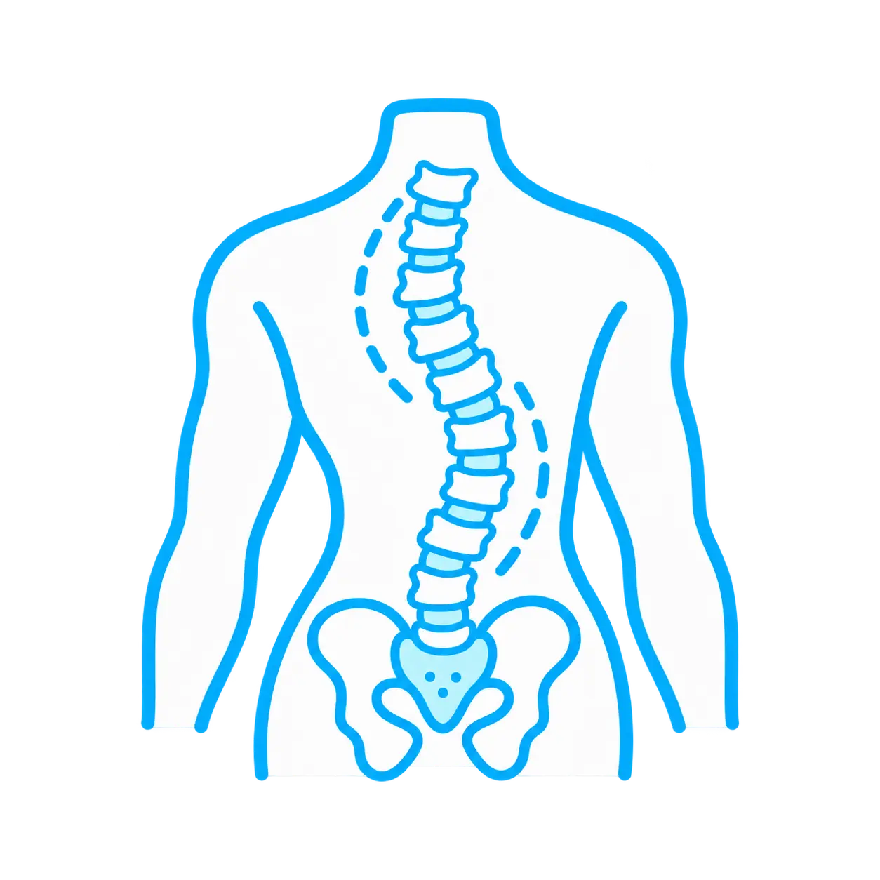 escoliosis