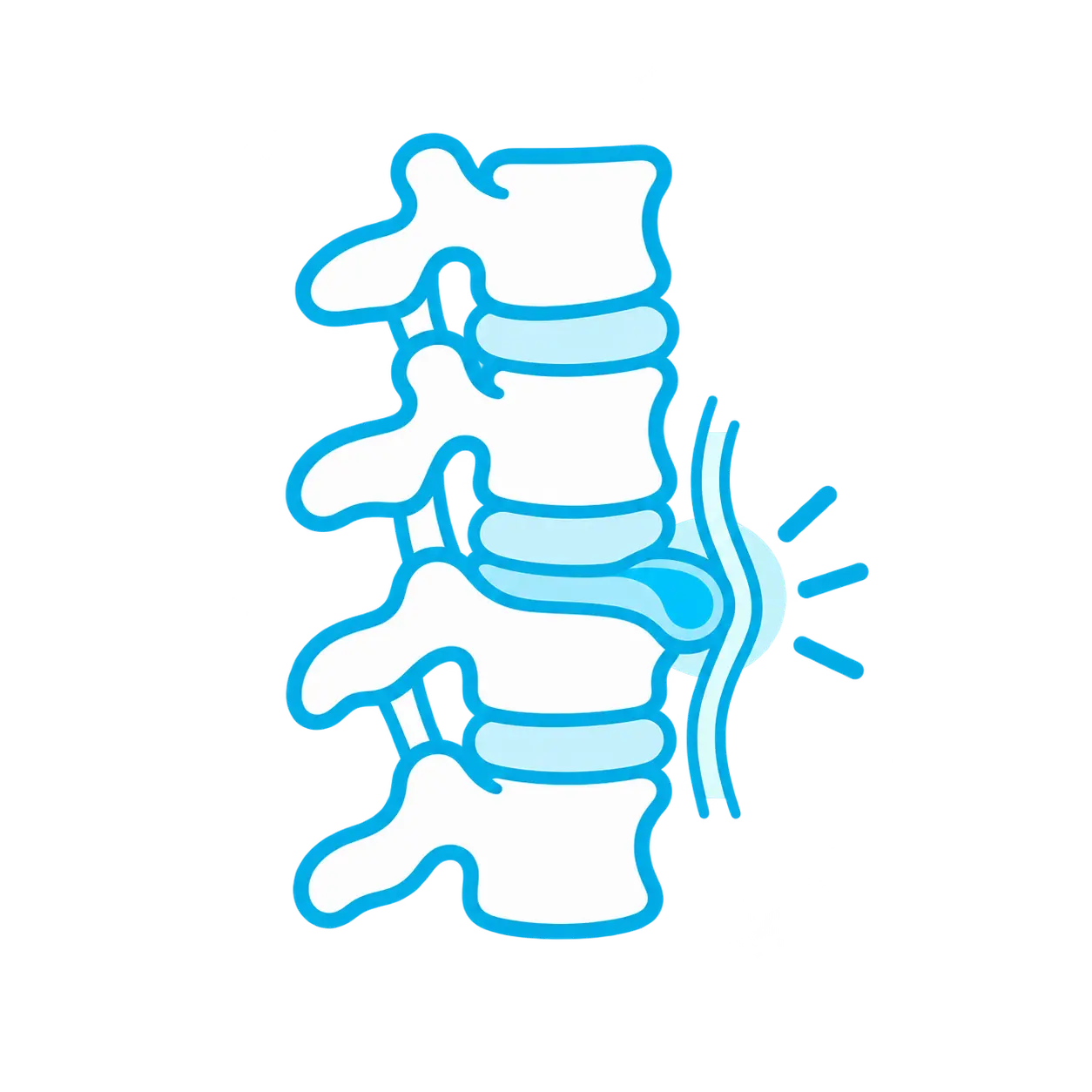 herniadisco